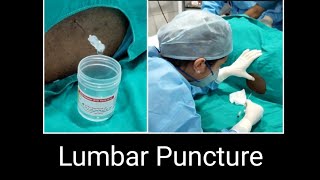 How to do Lumbar Puncture  How to do CSF study [upl. by Ahsaele630]