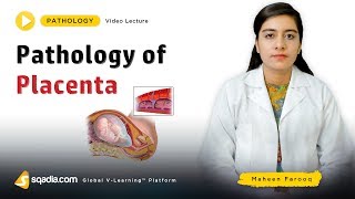 Pathology of Placenta  Video Lecture  Medical Student Education  VLearning [upl. by Van332]