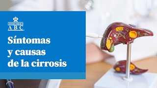 Síntomas y causas de la cirrosis [upl. by Drusie]