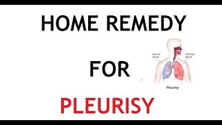 5 Home Remedy for Pleurisy [upl. by Anuahsed]