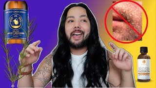 How I treat my FaceScalp Psoriasis Seborrheic Dermatitis natural home remedies [upl. by Outlaw]