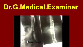 Dr G Medical Examiner 110 [upl. by Gurney]