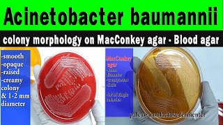 Acinetobacter colony morphology on MacConkey agarBlood agar diagnostic featurespreventive methods [upl. by Ofloda381]