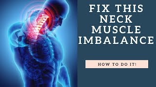 FIX This Neck Muscle Imbalance To Stop Neck Pain And Headaches [upl. by Awra]