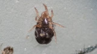 Biting Bird Mites Under the Microscope  Ornithonyssus sp [upl. by Shurwood]