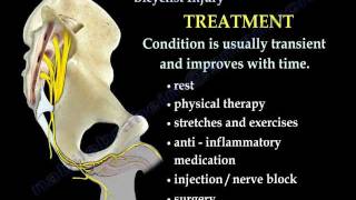 Pudendal Nerve Palsy Bicyclist nerve Injury  Everything You Need To Know  Dr Nabil Ebraheim [upl. by Osborne]