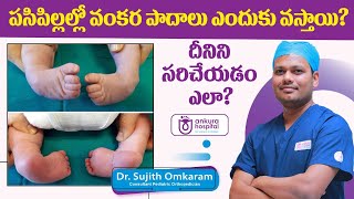 Best Treatment to Correct Clubfoot in Newborns  Dr Sujith Omkaram  Ankura Hospitals [upl. by Volpe496]