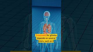 Treatment Options for Glioma Including Homeopathy [upl. by Grassi]