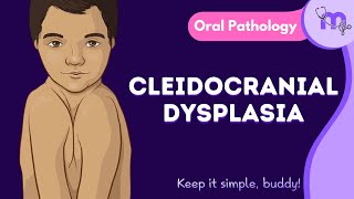 Cleidocranial Dysplasia  Features  Oral Manifestation  Treatment  Oral Pathology  Animated [upl. by Anes]