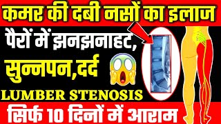 लंबर स्टेनोसिस की एक्सरसाइजSpinal Stenosis ExerciseLumbar Stenosis Exercises [upl. by Faye771]