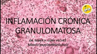 INFLAMACIÓN CRÓNICA GRANULOMATOSA  Dr Elmer Luna Vilchez [upl. by Raseta844]