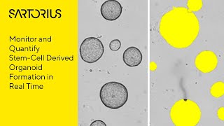 Incucyte Webinar Preview Studying 3D Organoids with LiveCell Analysis [upl. by Ayerf]