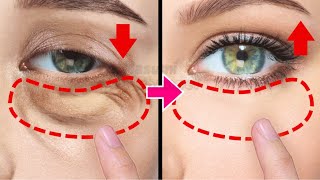 10mins🔥 Eye Lifting Exercises for Bigger Eyes Eye Bags Wrinkles Dark Circles Under Eyes [upl. by Zuzana]