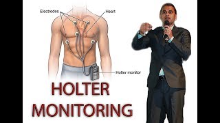 HOLTER MONITORING [upl. by Chaudoin]