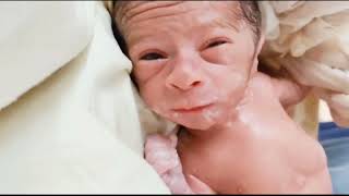 Newborn baby looking like old man IUGR after birth  born different baby cute love music [upl. by Lelia]