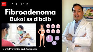 What is Fibroadenoma Bukol sa Dibdib [upl. by Leeke]