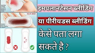 Implantation Bleeding Symptoms Implantationbleedingklakshn​garbhwatihoneklakshn [upl. by Ahtanaram305]