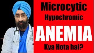 What is Microcytic hypochromic Anemia  DrEducation [upl. by Rachaba]