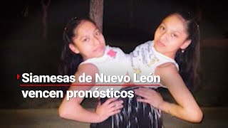 SIAMESAS QUINCEAÑERAS  Lupita y Elsa vencen los pronósticos médicos [upl. by Ennaj]