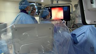 Mayo Clinic Minute Kidney stone surgeries [upl. by Basso]