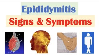 Epididymitis Scrotal Pain Signs amp Symptoms  amp Why They Occur [upl. by Aihsemek963]