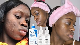 HOW TO CLEAR TEXTURED SKIN  My Fungal Acne Skincare Routine  The Ordinary Curology amp Cerave [upl. by Sito865]