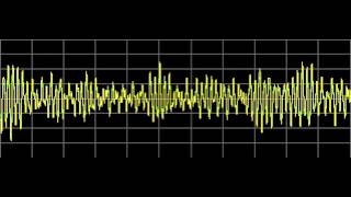 Constipation  Rife Frequencies [upl. by Maryjo902]