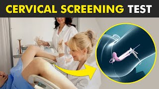 Pap Smear Pap Test  Early Detection for Cervical Cancer  Understanding the Procedure [upl. by Claresta]