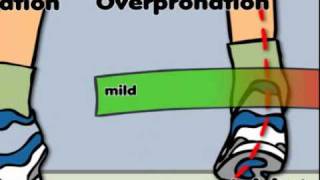 What is pronation [upl. by Keever]