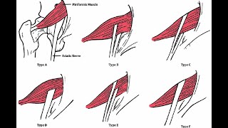 The sciatic nerve anatomy  origin course branches relations distribution and clinical anatomy [upl. by Latsyrhc]