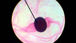 RHIZOPUS STOLONIFER SHOWING ZYGOSPORES [upl. by Ciaphus]