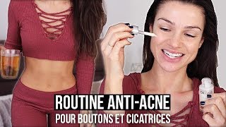 ROUTINE ANTIACNE Différence en 1 semaine [upl. by Nnylodnewg283]