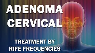 Adenoma Cervical  RIFE Frequencies Treatment  Energy amp Quantum Medicine with Bioresonance [upl. by Langbehn]