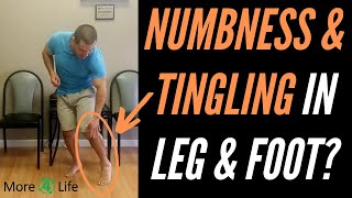 Numbness and Tingling In Leg and Foot [upl. by Bornie]