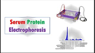 Clinical Chemistry 🔤  Serum Protein Electrophoresis [upl. by Merriman]