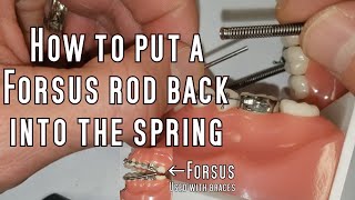 How to repair a Forsus with braces BY YOURSELF [upl. by Acinnad244]