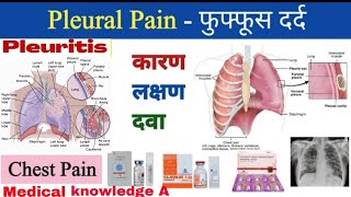 Pleuralpain  pleuraltitis संक्रमण के कारण और उपचार Chest pain in hindi फुफ्फूशीय दर्दnursing [upl. by Enywad]