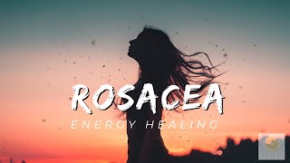 Rosacea Energy Healing  Healing at Hand [upl. by Ylrebmic89]