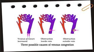 Hyperemia and Congestion [upl. by Coveney131]