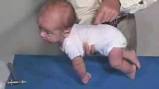 Neurology Exam 3 Month Primitive ReflexesGalant [upl. by Ttik]