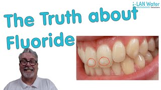 The Truth about Fluoride [upl. by Matthieu996]