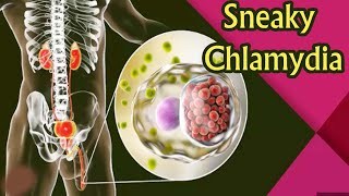 Sneaky Chlamydia Could You Have It Without Knowing [upl. by Chas]