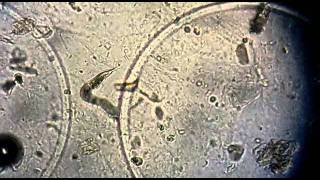 Strongyloides stercoralis no exame de urina EAS [upl. by Avery]