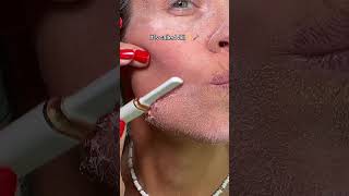 Have you ever tried dermaplaning [upl. by Riccio]