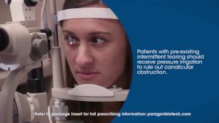 Inserting Comfortear® Punctum Plugs [upl. by Analra]