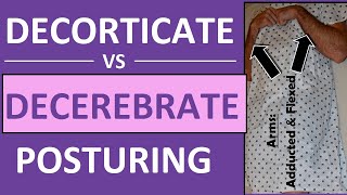 Decerebrate vs Decorticate Posturing Rigidity Mnemonic amp Pictures Nursing NCLEX [upl. by Eruza]