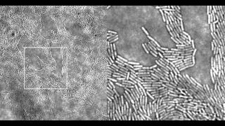 Pseudomonas aeruginosa Twitching Motility Type IV Pili in Action Supplemental Video 1 [upl. by Kutzenco]