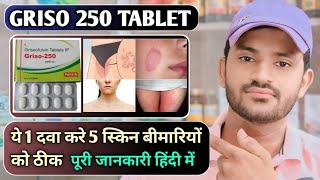 Griso 250 tablet uses dose benefits and Side effects full review in hindi [upl. by Keriann]