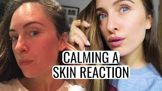 HOW TO CALM A SKIN REACTION  Tiny Bumps Redness Cystic Acne and more [upl. by Tiffi]