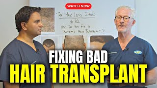 How To Correct A Botched Hair Transplant [upl. by Rubie]